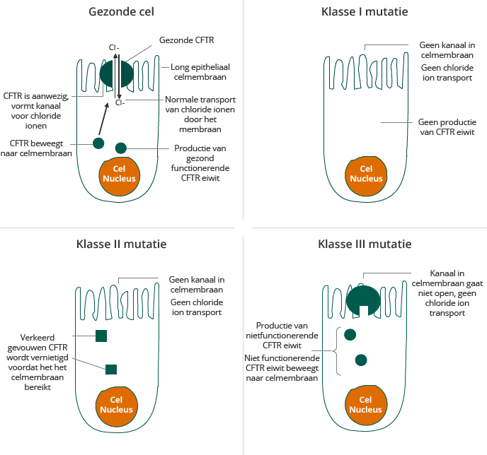 CF mutaties (illustration)